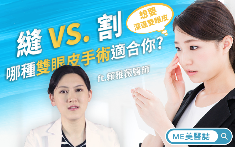 縫雙眼皮VS割雙眼皮 你適合哪種雙眼皮手術？