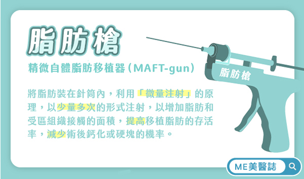 精微自體脂肪移植器（MAFT-gun）