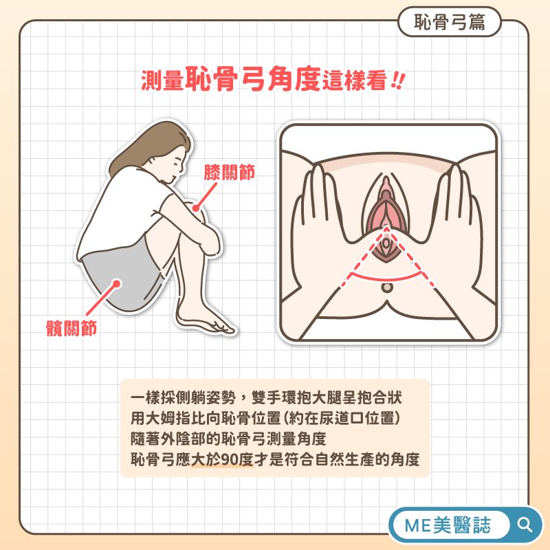 恥骨弓測量方法