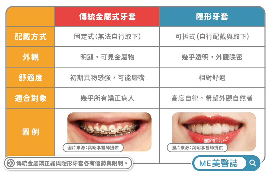 傳統牙套和隱形牙套比較