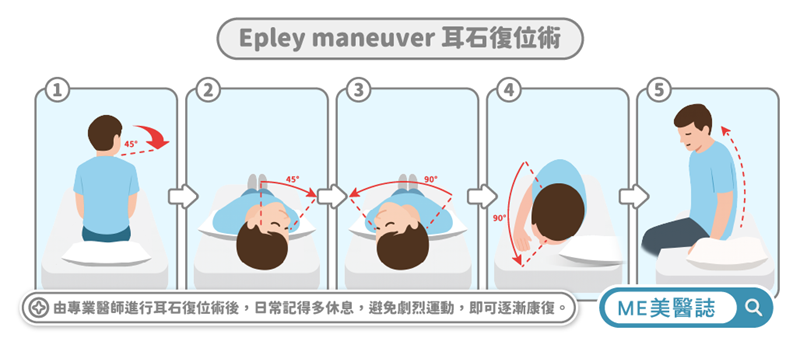 耳石復位術步驟圖解
