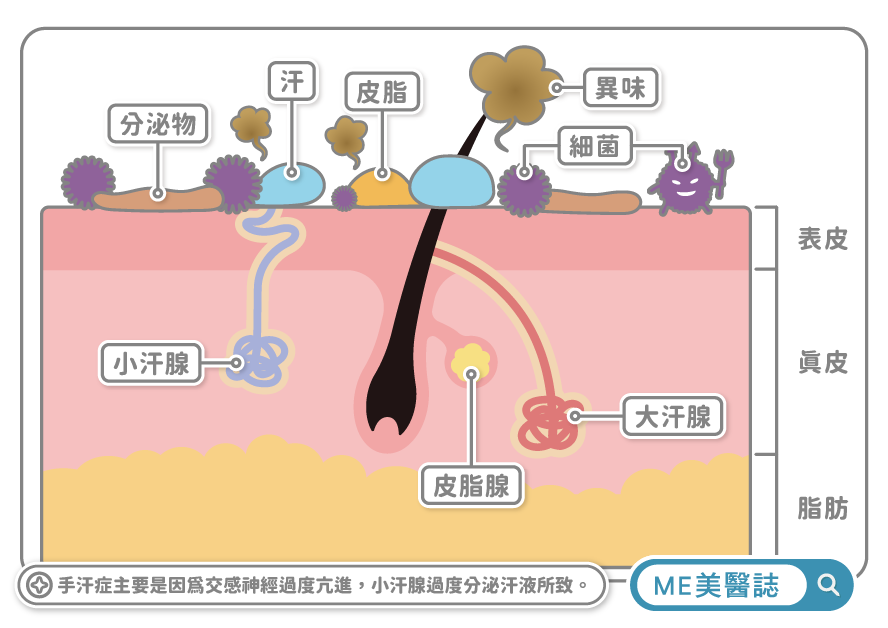 多汗症與小汗腺機制圖解