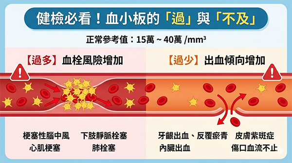 血小板