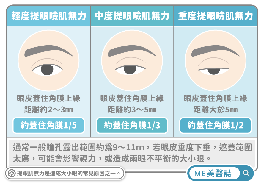 提眼肌無力嚴重程度