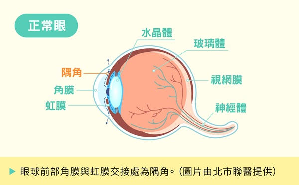 眼睛隅角