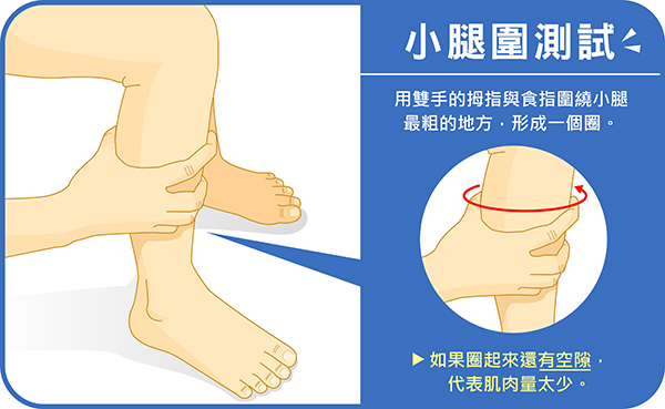 1151015-4-小腿圍測試:用雙手的拇指與食指圍繞小腿最粗的地方,如果圈起來還有空隙,代表肌肉量太少(圖片由北市聯醫提供)