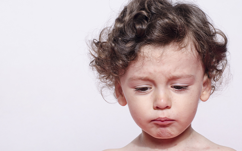 社經弱勢與幼童近視恐提高肥胖機率