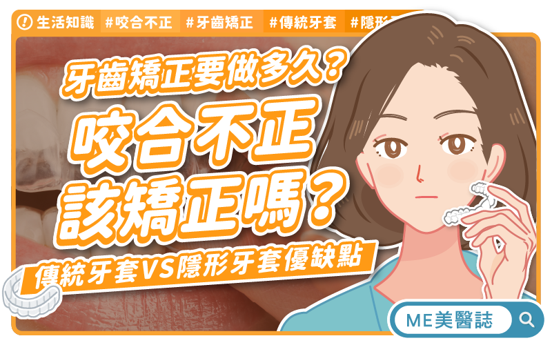 咬合不正要治療嗎？隱形牙套優缺點？牙齒矯正後的注意事項
