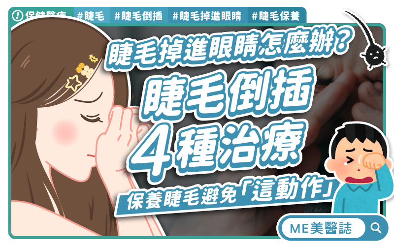 睫毛掉進眼睛怎麼辦？睫毛倒插怎治療？日常4招保養睫毛