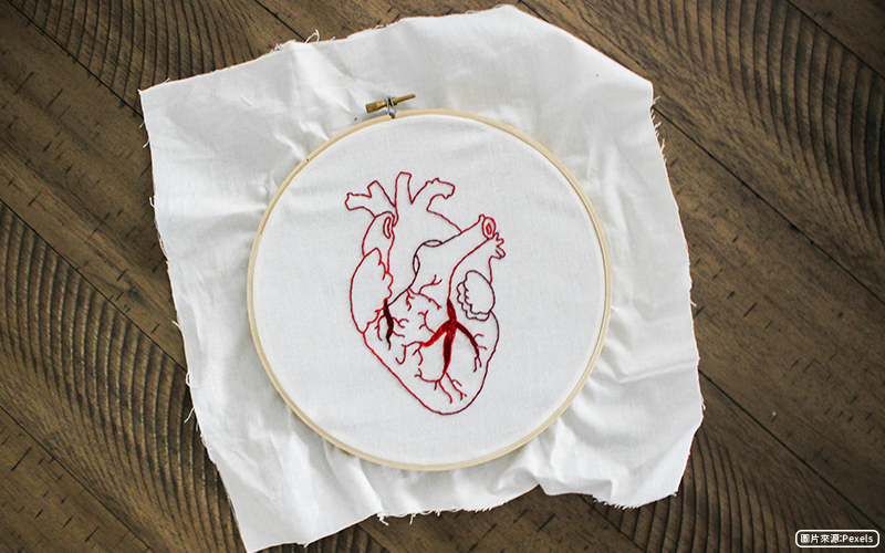 心血管支架再阻塞，不可忽視的隱形危機