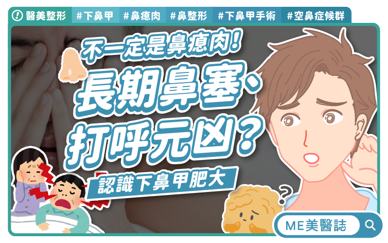 長期鼻塞、打呼元凶就是它？下鼻甲肥大治療方式，一定要手術嗎？