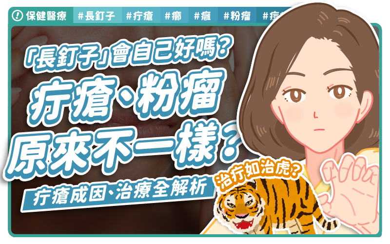 長出這顆千萬別擠!不只是痘痘?「長釘子」別輕忽,醫師揭「疔瘡」正確治療方式–保健醫療|ME美醫誌