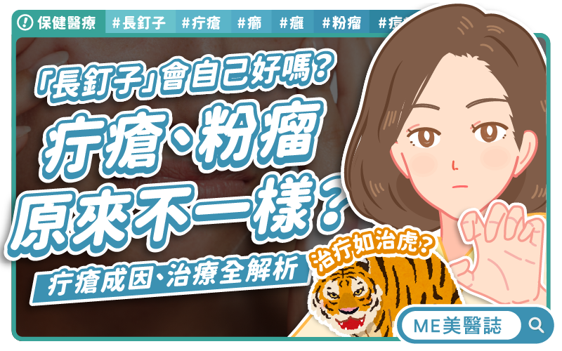 長出這顆千萬別擠！不只是痘痘？「長釘子」別輕忽，醫師揭「疔瘡」正確治療方式