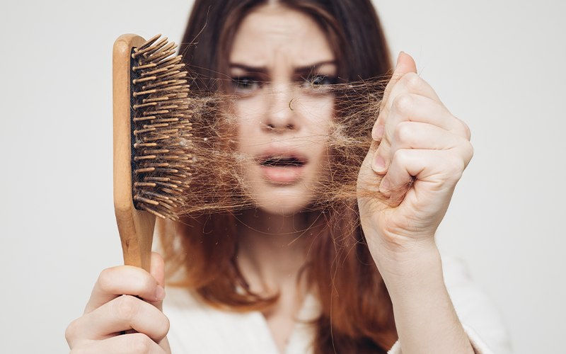 禿頭治療新福音，美顏針改善M型禿實例