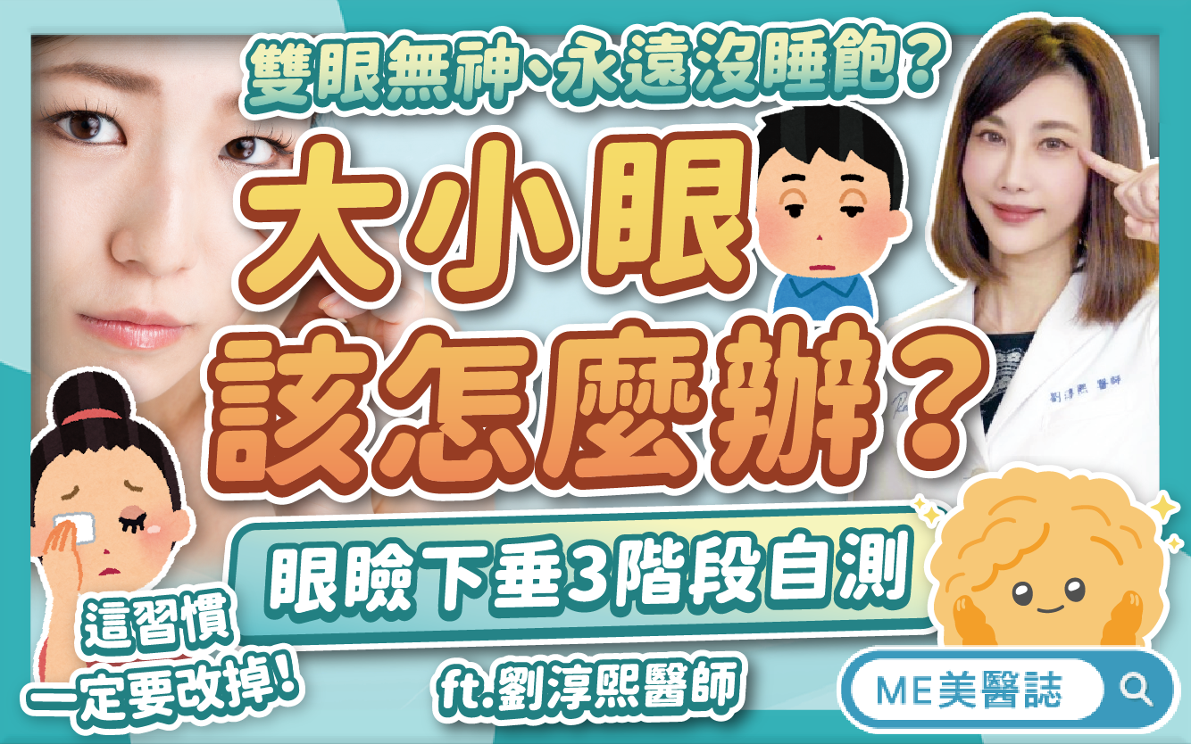 大小眼不一定是提眼肌無力害的？揭密眼睛無神原因！肥厚眼皮這樣救