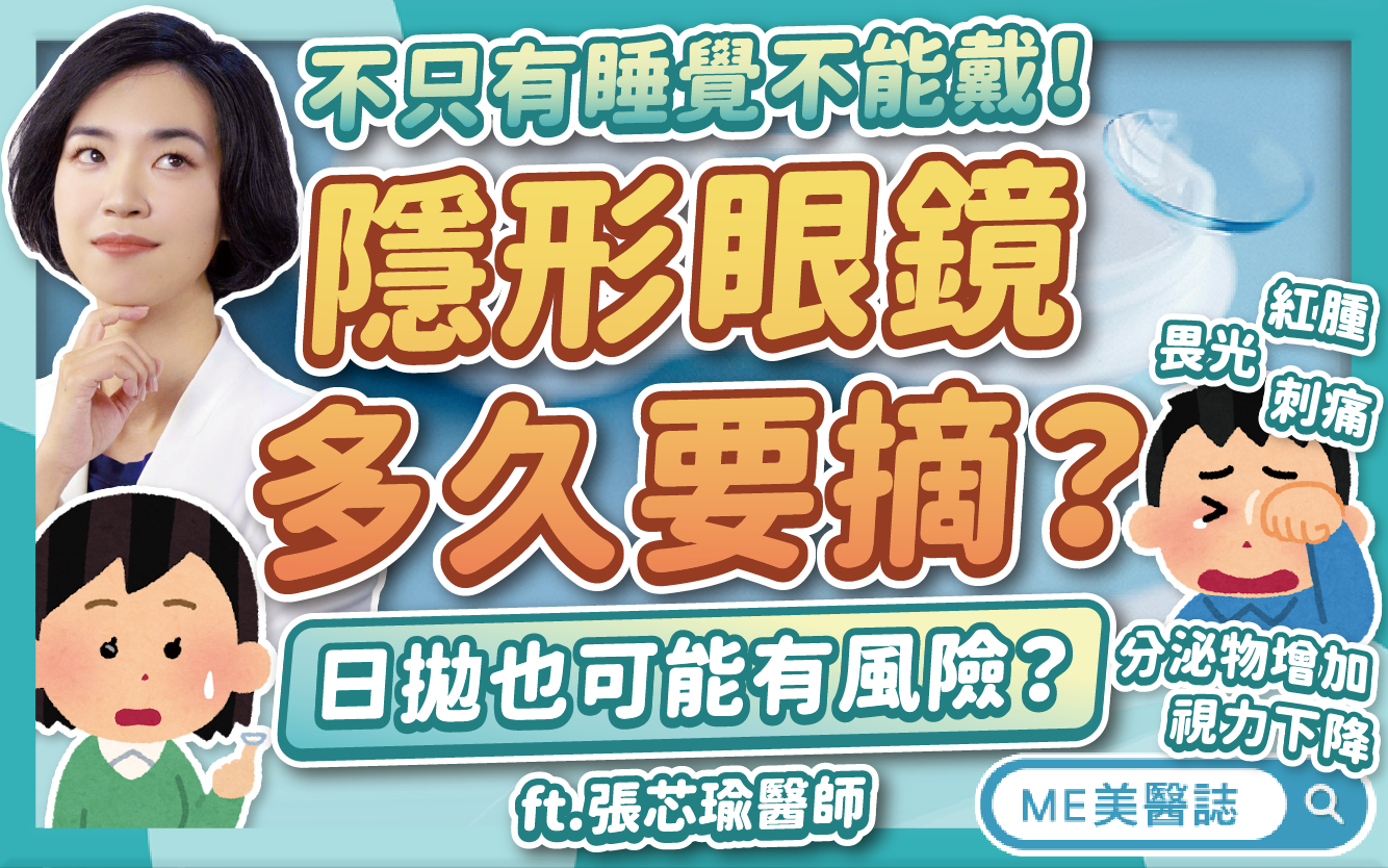 隱形眼鏡「多戴久一點」不會怎麼樣？不只戴著睡覺，這些壞習慣都不行
