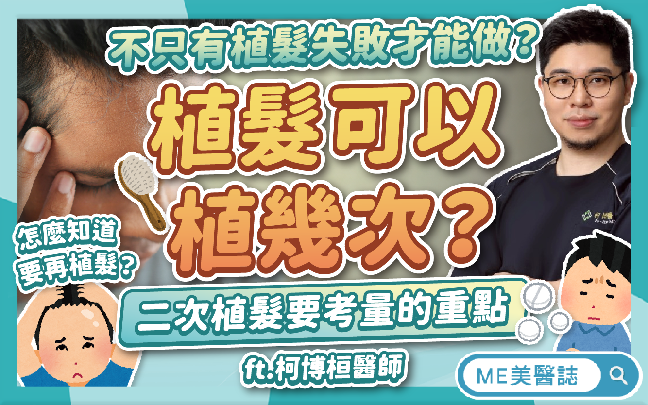 植髮可以植很多次嗎？不只有植髮失敗才能做？「二次植髮」注意事項！