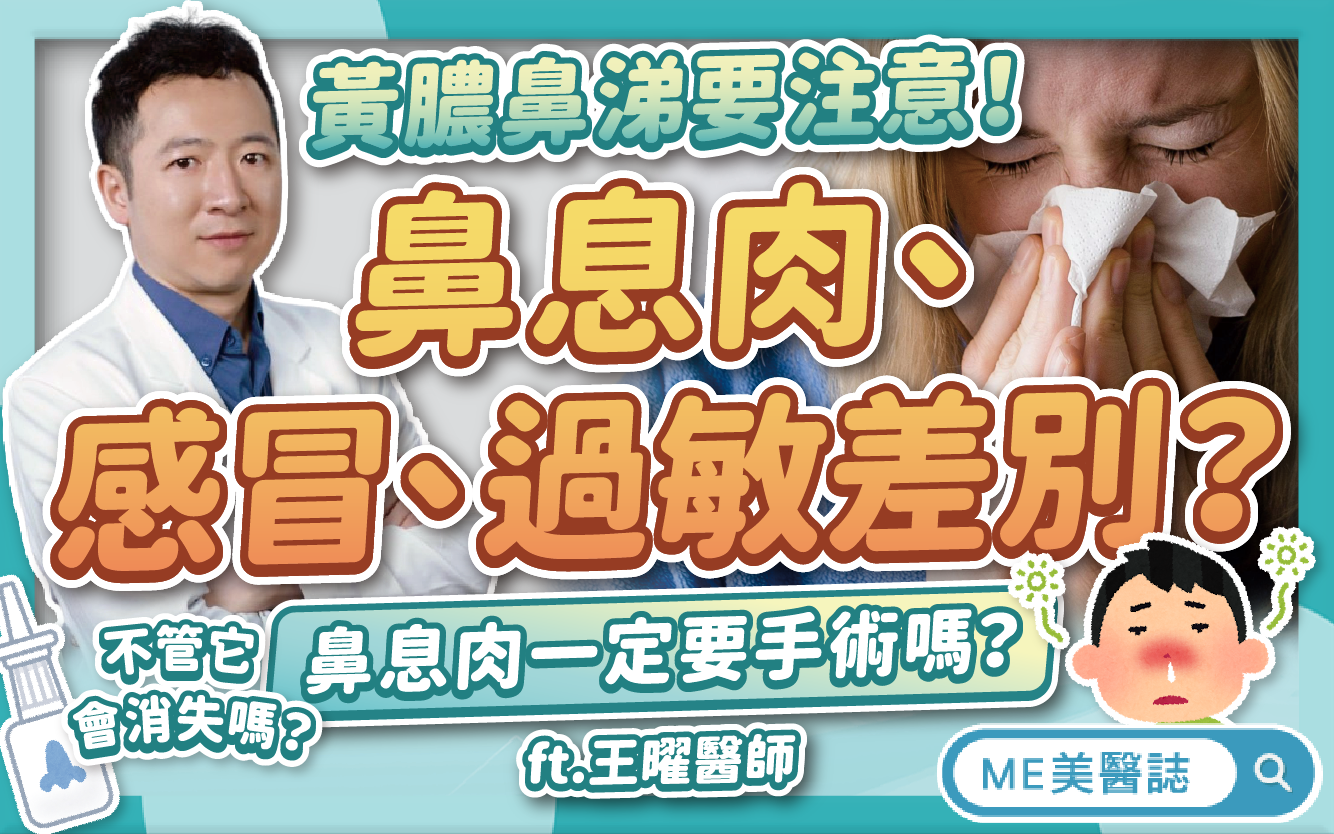 黃膿狀鼻涕當心「鼻息肉」在作怪！跟感冒、過敏差別？這些症狀要注意