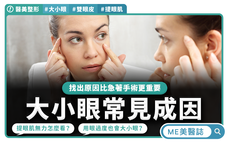 大小眼怎麼改善?別急著做雙眼皮手術!提眼肌無力可能才是關鍵