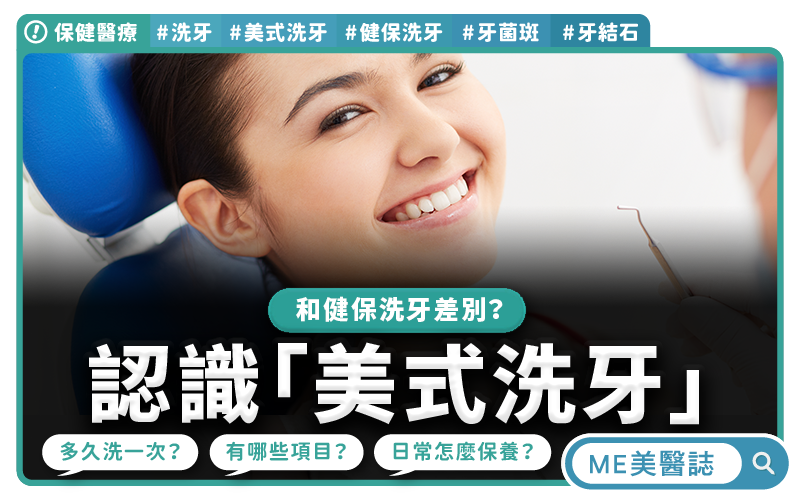 原來洗牙也有不同方式？一次看懂「美式洗牙」和「健保洗牙」差異