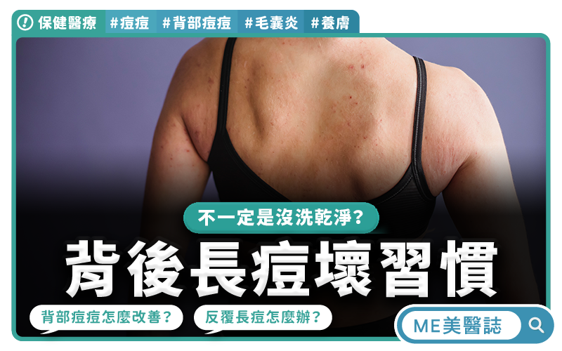 背後反覆長痘痘是因為沒洗乾淨?越熱衷「這件事」小心皮膚屏障更糟!